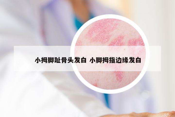 小拇脚趾骨头发白 小脚拇指边缘发白