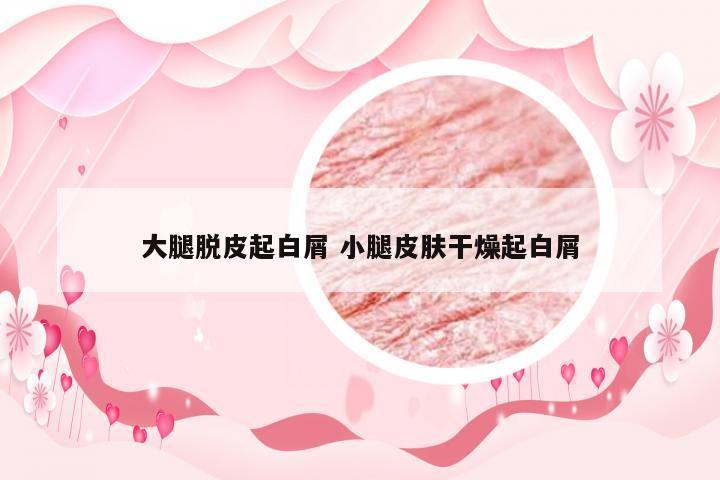 大腿脱皮起白屑 小腿皮肤干燥起白屑