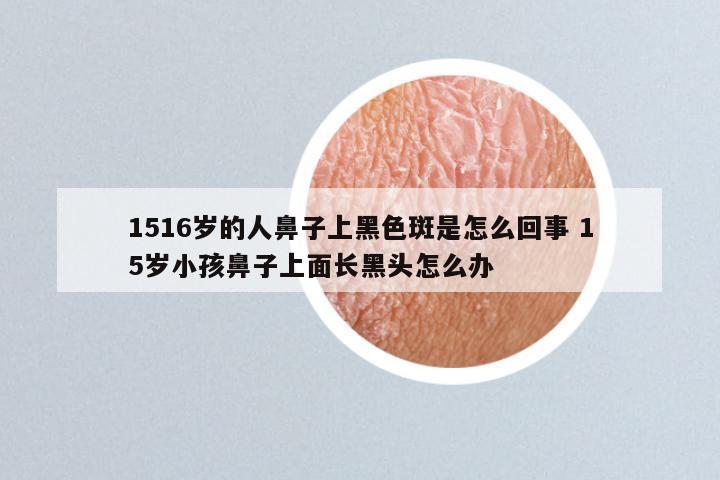 1516岁的人鼻子上黑色斑是怎么回事 15岁小孩鼻子上面长黑头怎么办