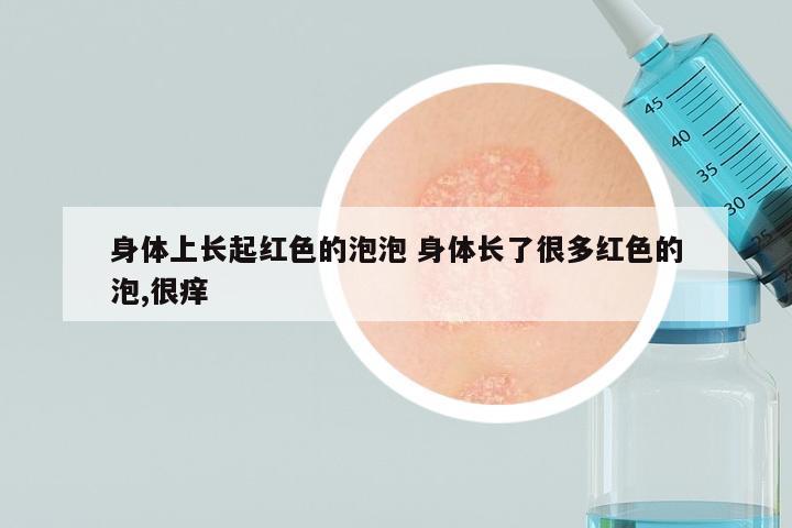 身体上长起红色的泡泡 身体长了很多红色的泡,很痒