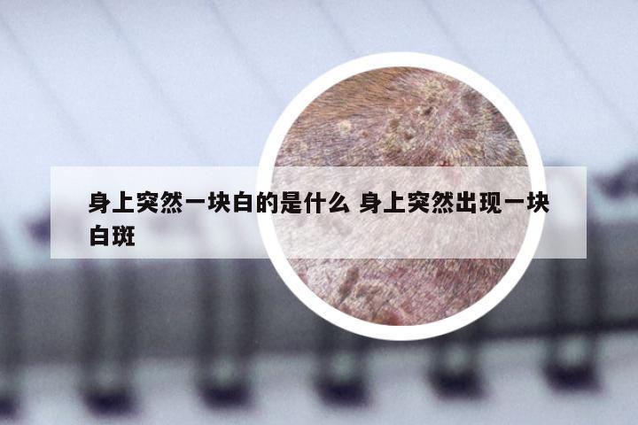 身上突然一块白的是什么 身上突然出现一块白斑