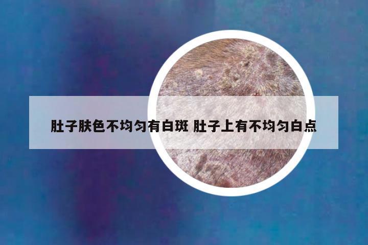 肚子肤色不均匀有白斑 肚子上有不均匀白点