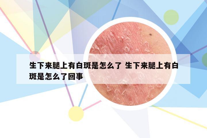 生下来腿上有白斑是怎么了 生下来腿上有白斑是怎么了回事