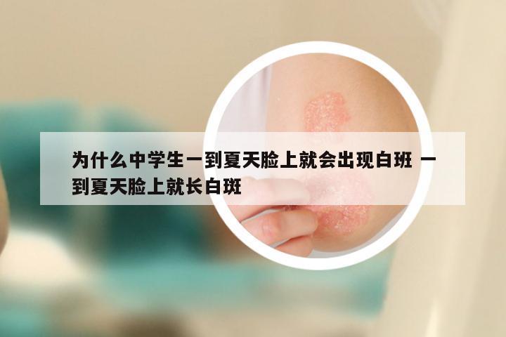 为什么中学生一到夏天脸上就会出现白班 一到夏天脸上就长白斑