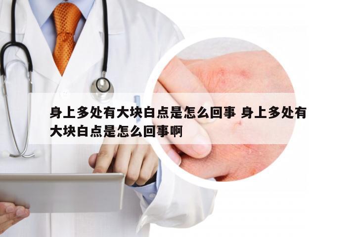 身上多处有大块白点是怎么回事 身上多处有大块白点是怎么回事啊