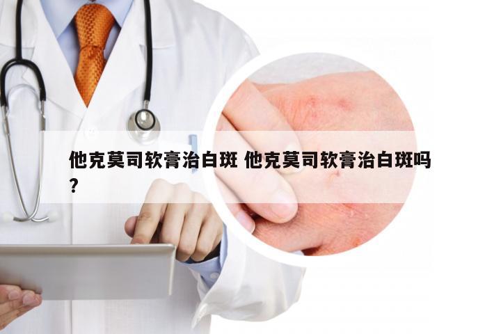 他克莫司软膏治白斑 他克莫司软膏治白斑吗?