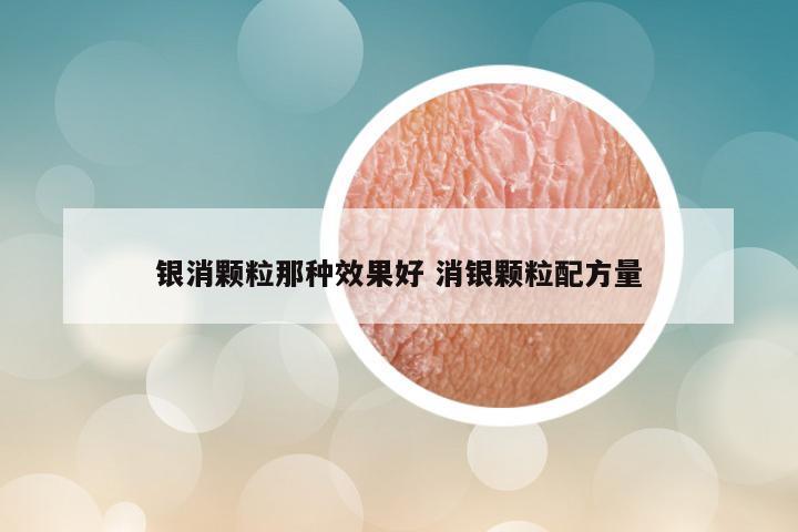 银消颗粒那种效果好 消银颗粒配方量