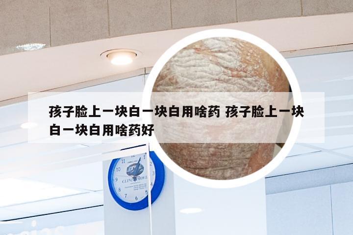 孩子脸上一块白一块白用啥药 孩子脸上一块白一块白用啥药好