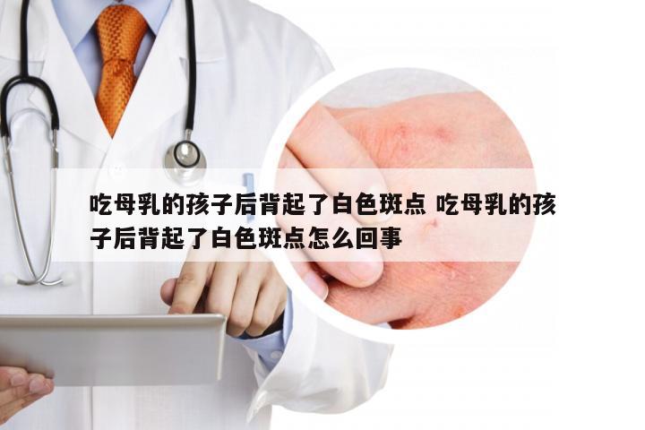 吃母乳的孩子后背起了白色斑点 吃母乳的孩子后背起了白色斑点怎么回事