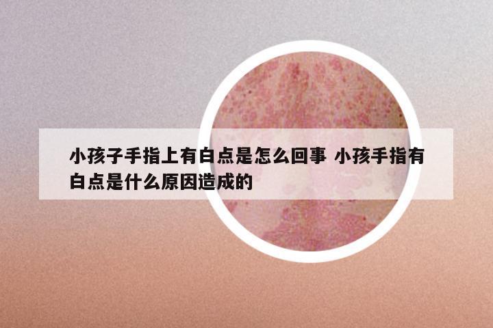 小孩子手指上有白点是怎么回事 小孩手指有白点是什么原因造成的