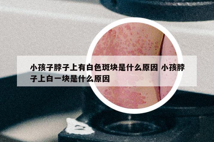 小孩子脖子上有白色斑块是什么原因 小孩脖子上白一块是什么原因