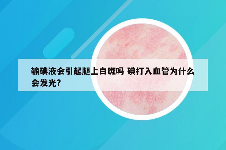 输碘液会引起腿上白斑吗 碘打入血管为什么会发光?