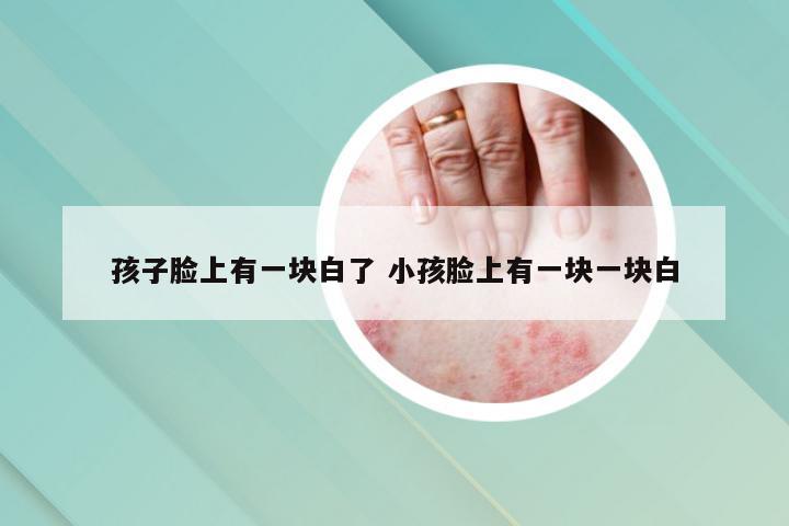 孩子脸上有一块白了 小孩脸上有一块一块白