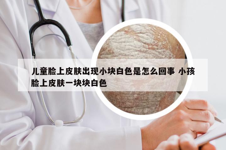 儿童脸上皮肤出现小块白色是怎么回事 小孩脸上皮肤一块块白色