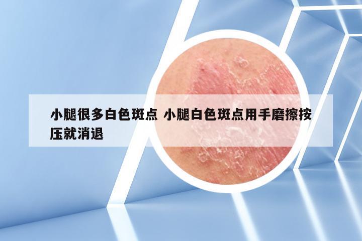 小腿很多白色斑点 小腿白色斑点用手磨擦按压就消退