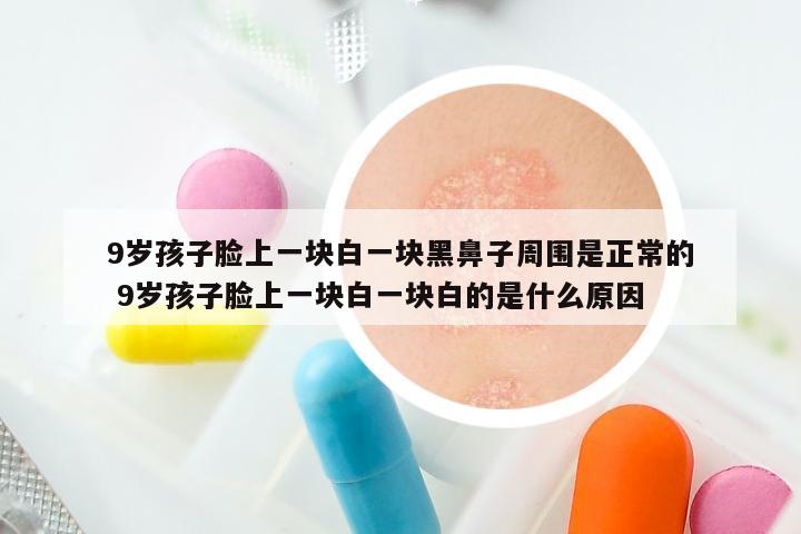 9岁孩子脸上一块白一块黑鼻子周围是正常的 9岁孩子脸上一块白一块白的是什么原因