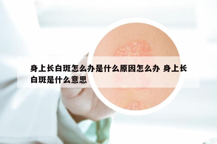 身上长白斑怎么办是什么原因怎么办 身上长白斑是什么意思