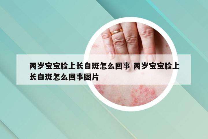 两岁宝宝脸上长白斑怎么回事 两岁宝宝脸上长白斑怎么回事图片