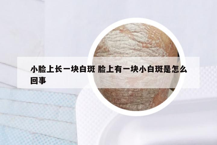 小脸上长一块白斑 脸上有一块小白斑是怎么回事
