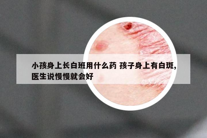 小孩身上长白班用什么药 孩子身上有白斑,医生说慢慢就会好