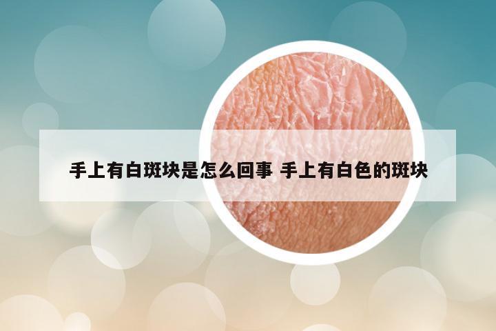 手上有白斑块是怎么回事 手上有白色的斑块