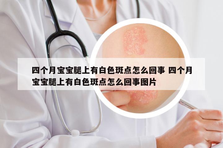 四个月宝宝腿上有白色斑点怎么回事 四个月宝宝腿上有白色斑点怎么回事图片