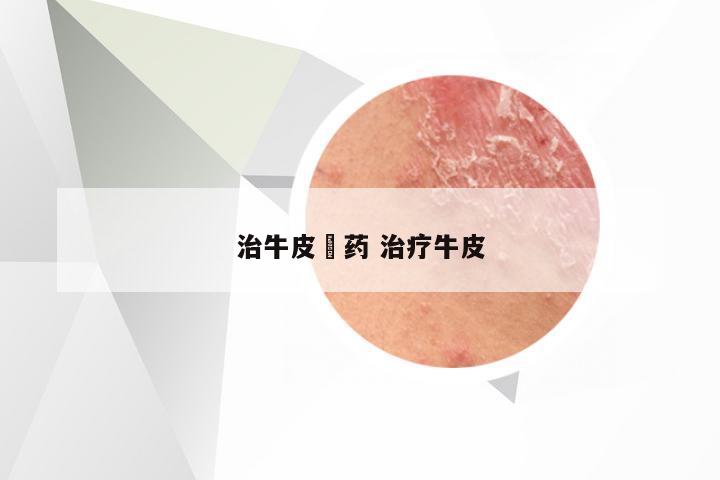 治牛皮痟药 治疗牛皮