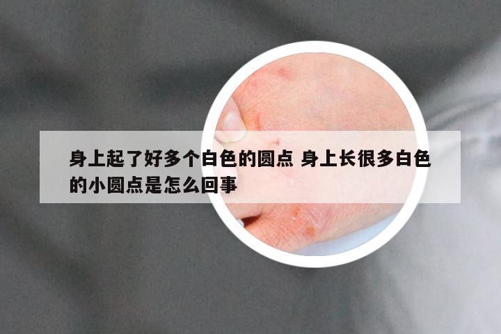 身上起了好多个白色的圆点 身上长很多白色的小圆点是怎么回事