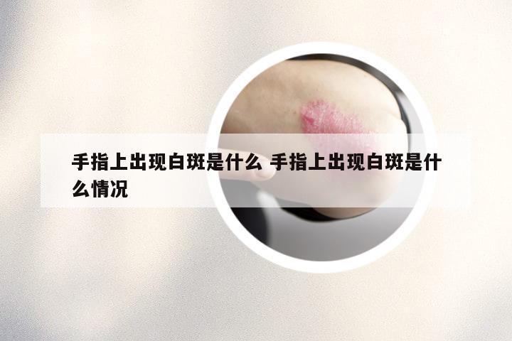 手指上出现白斑是什么 手指上出现白斑是什么情况