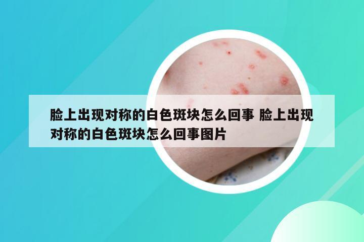 脸上出现对称的白色斑块怎么回事 脸上出现对称的白色斑块怎么回事图片