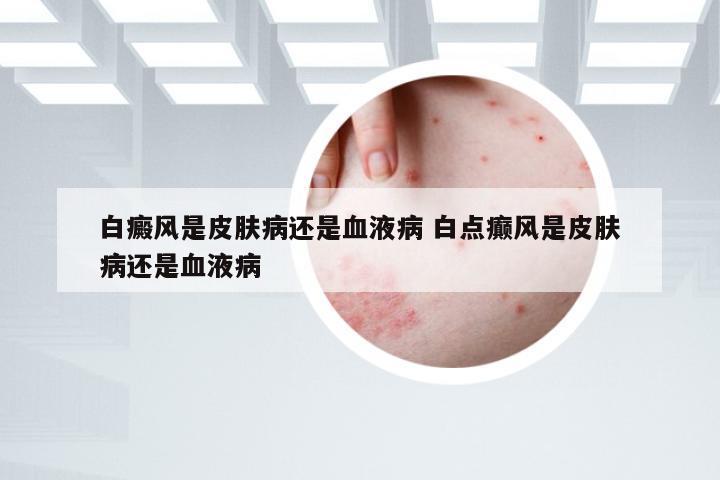 白癜风是皮肤病还是血液病 白点癫风是皮肤病还是血液病