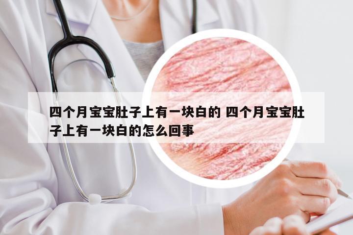 四个月宝宝肚子上有一块白的 四个月宝宝肚子上有一块白的怎么回事