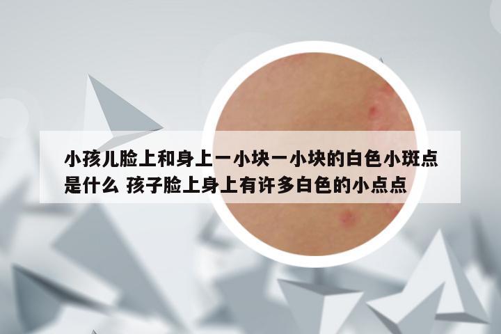 小孩儿脸上和身上一小块一小块的白色小斑点是什么 孩子脸上身上有许多白色的小点点