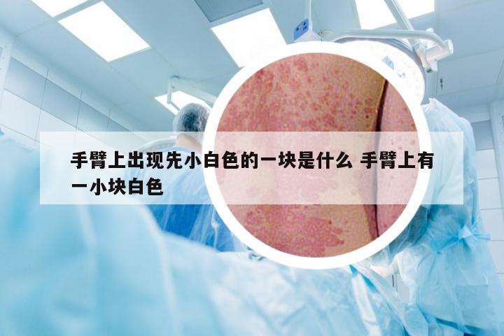 手臂上出现先小白色的一块是什么 手臂上有一小块白色
