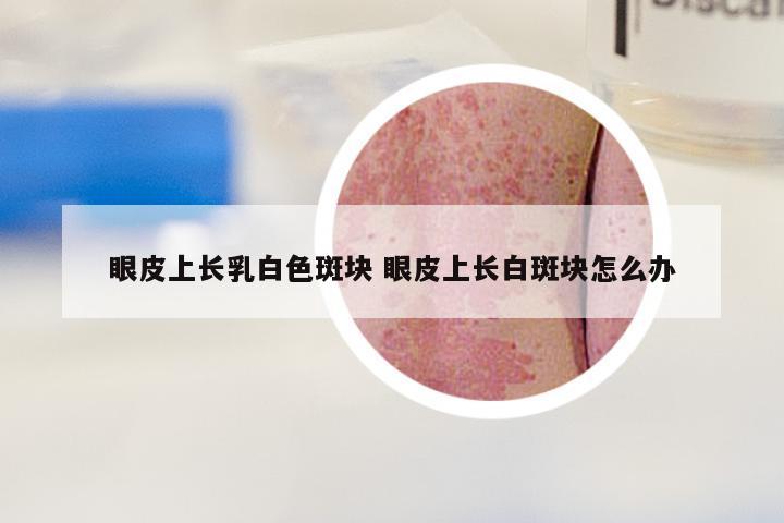 眼皮上长乳白色斑块 眼皮上长白斑块怎么办