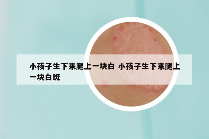 小孩子生下来腿上一块白 小孩子生下来腿上一块白斑