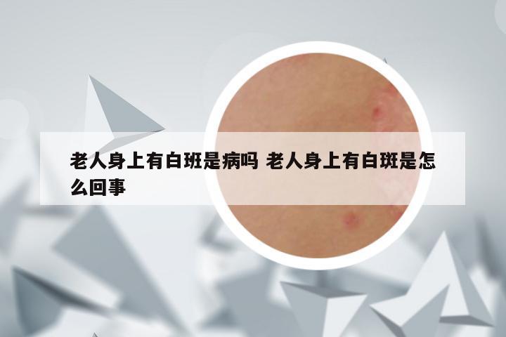 老人身上有白班是病吗 老人身上有白斑是怎么回事
