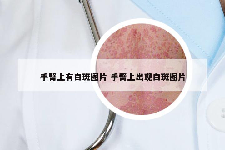 手臂上有白斑图片 手臂上出现白斑图片