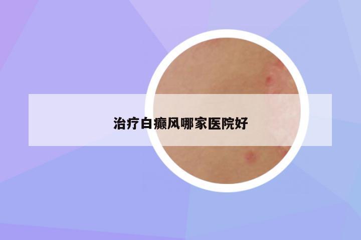 治疗白癫风哪家医院好
