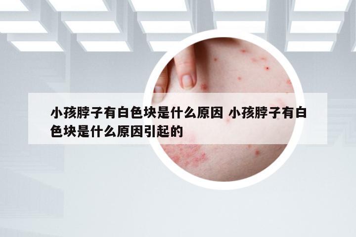 小孩脖子有白色块是什么原因 小孩脖子有白色块是什么原因引起的