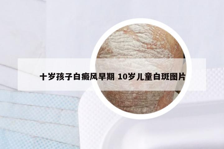 十岁孩子白癜风早期 10岁儿童白斑图片