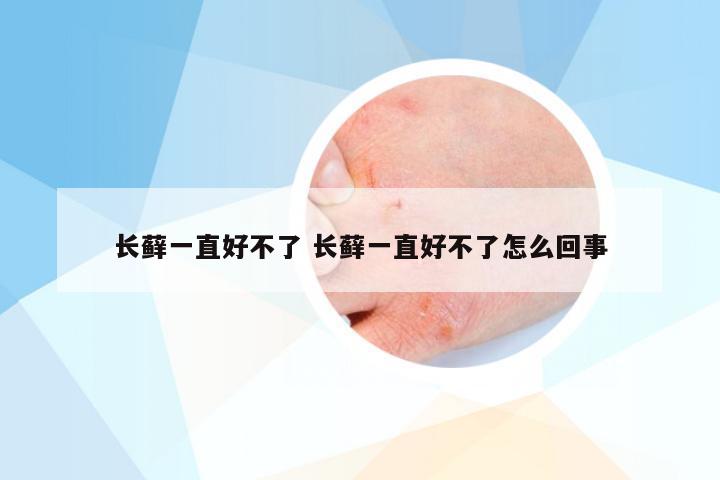 长藓一直好不了 长藓一直好不了怎么回事