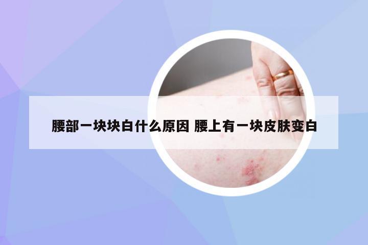 腰部一块块白什么原因 腰上有一块皮肤变白