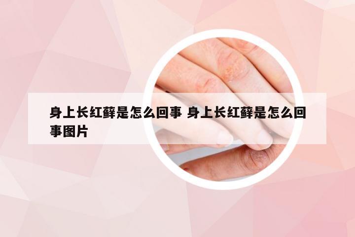身上长红藓是怎么回事 身上长红藓是怎么回事图片