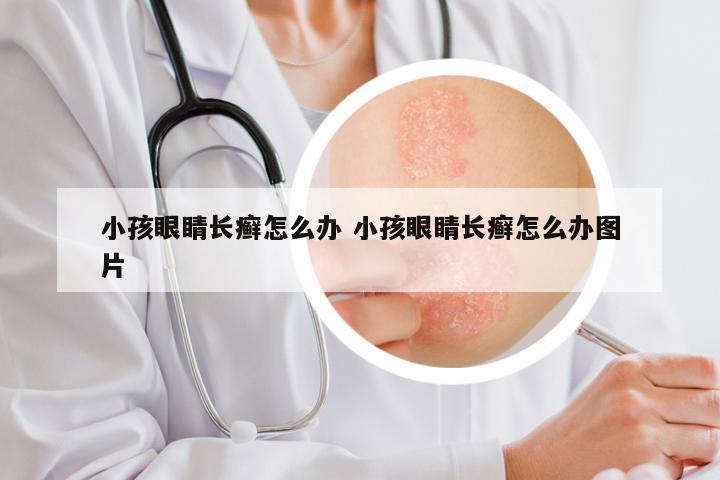小孩眼睛长癣怎么办 小孩眼睛长癣怎么办图片