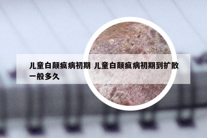 儿童白颠疯病初期 儿童白颠疯病初期到扩散一般多久