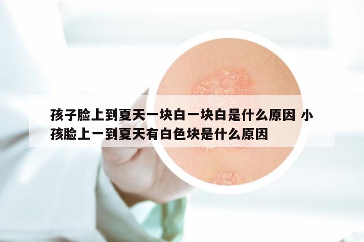 孩子脸上到夏天一块白一块白是什么原因 小孩脸上一到夏天有白色块是什么原因