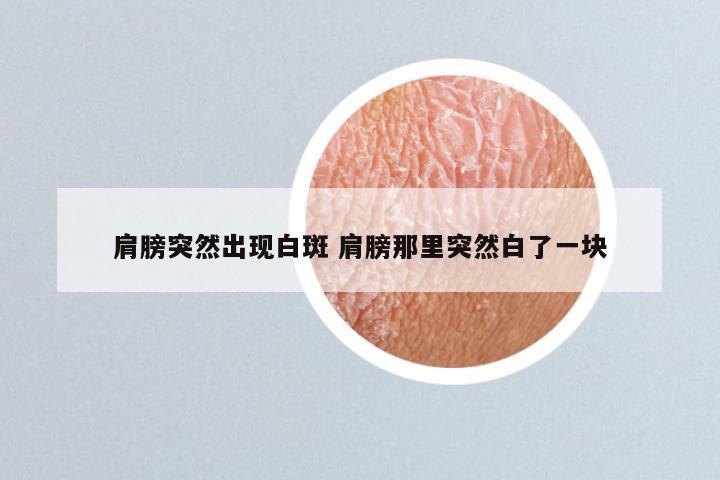 肩膀突然出现白斑 肩膀那里突然白了一块