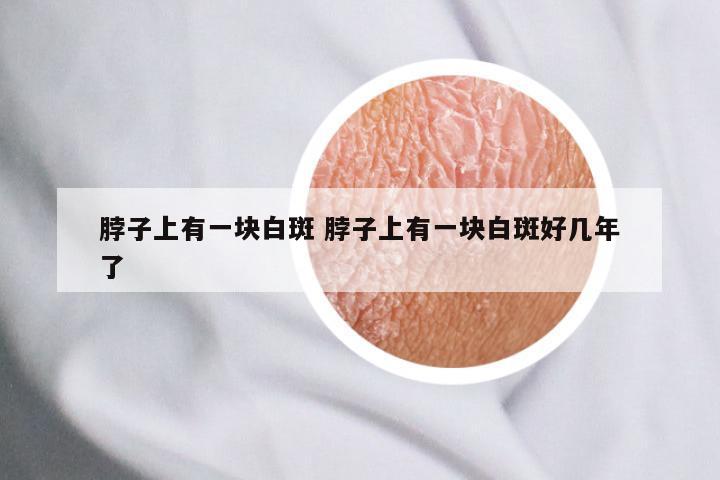 脖子上有一块白斑 脖子上有一块白斑好几年了