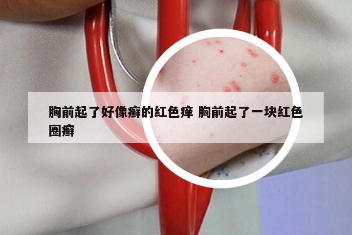 胸前起了好像癣的红色痒 胸前起了一块红色圈癣
